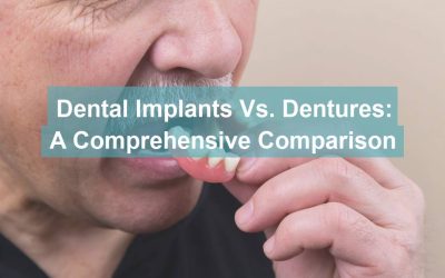 Dental Implants vs. Dentures: A Comprehensive Comparison