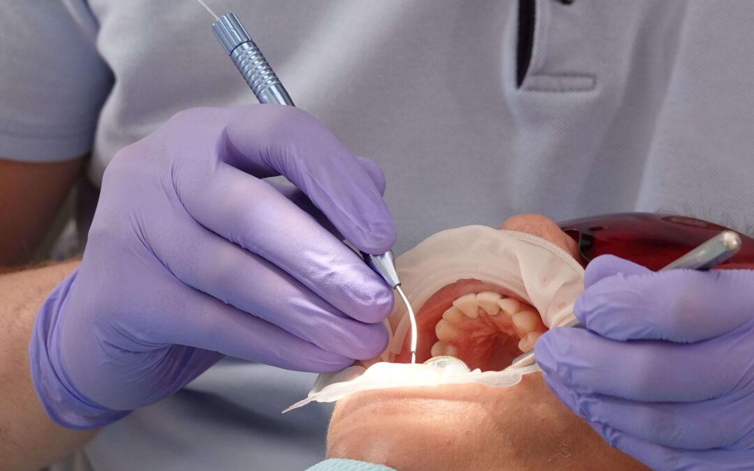 Dental Bridge Procedure Guide from Columbia Experts