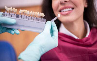 Dental Veneers vs. Crowns in Columbia, SC: Which Is the Right Choice?