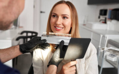 Replacing Old Veneers in Columbia, SC: What Patients Should Expect