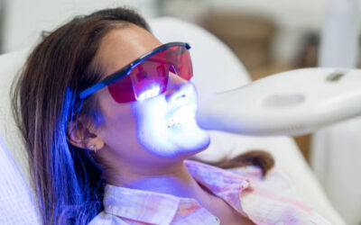 Professional Teeth Whitening in Columbia, SC: What Patients Should Know