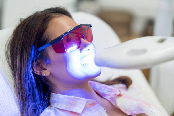 Professional Teeth Whitening in Columbia, SC: What Patients Should Know